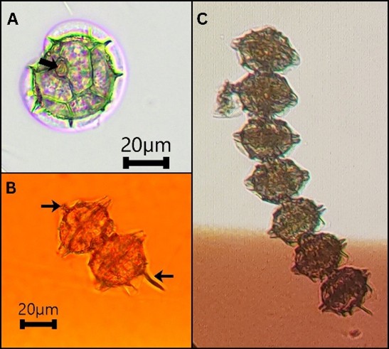 Light microscopy images of Pyrodinium bahamense at 100x magnification. (A) Apical view showing the plates and the apical attachment pore (arrow); (B) cells showing an apical spine (upper arrow) and an antapical spine (lower arrow); (C) cells in chains.
